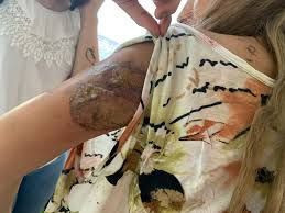 İstanbul'da kızgın bıçakla eşini yakıp zorla ilişkiye girdi! Anlattıkları kan dondurdu - Resim: 4