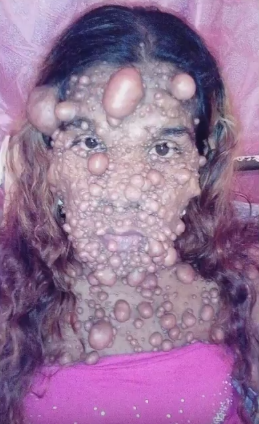 Görenler korkup kaçıyor canavar diye sesleniyorlar - Resim: 4