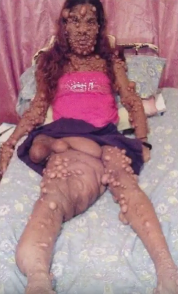 Görenler korkup kaçıyor canavar diye sesleniyorlar - Resim: 2