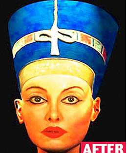 En ilginç estetik operasyonlar - Resim: 4