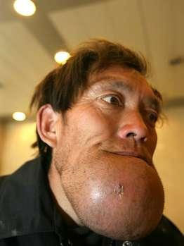 Dünyanın en tuhaf rahatsızlıkları - Resim: 1