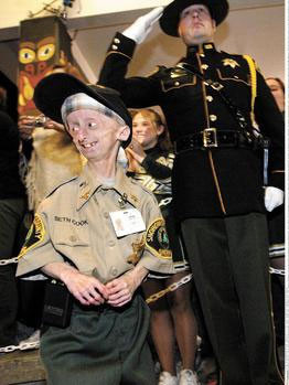 Dünyanın en tuhaf rahatsızlıkları - Resim: 2