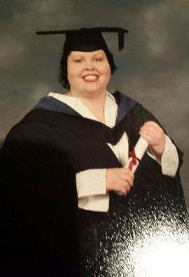 Kilo verdikten sonra hayatı kabusa döndü - Resim: 1