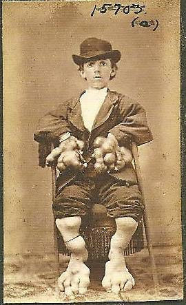 Tarihi sirk ucubeleri - Resim: 3