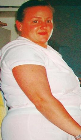 107 kilodan 48'e böyle düştü - Resim: 4