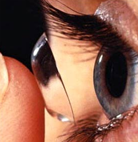 Yaz aylarında kontak lens kuruluk sebebi - Resim: 1