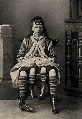 Tarihi sirk ucubeleri - Resim: 1