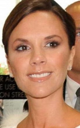 Ünlülerin eski dişlerine bakın! - Resim: 3