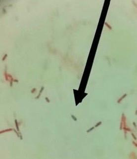 Bilim insanları uçak yakıtında yeni bir bakteri cinsi keşfetti - Resim: 1