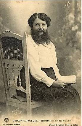 Tarihi sirk ucubeleri - Resim: 2