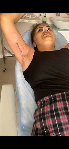 Bir estetik faciası daha! Burun kemikleri eriyip genzinden düştü - Resim: 3