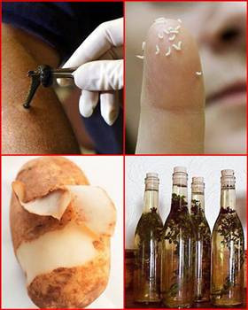 Tuhaf tedavi yöntemleri - Resim: 1