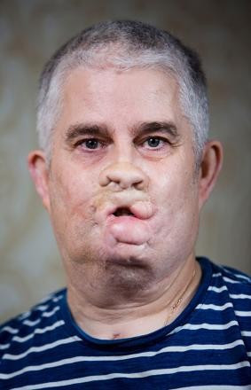 Dişçide iğne oldu kollarını ve bacağını kaybetti! - Resim: 2