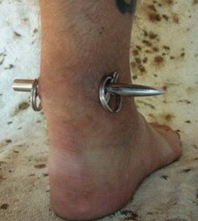 Onların her yeri delik deşik - Resim: 3