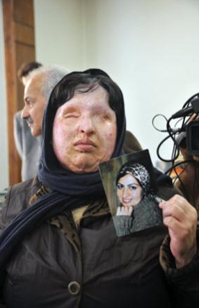 O adamı son anda affetti - Resim: 2