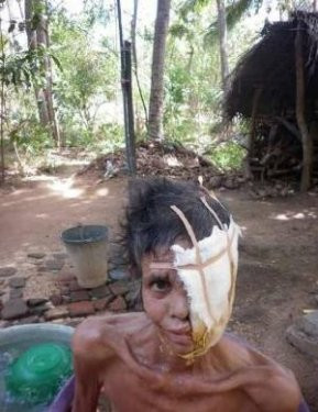 Et yiyen virüs kadının yüzünü yedi - Resim: 3