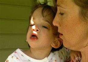 Dev bacaklı kadın - Resim: 1