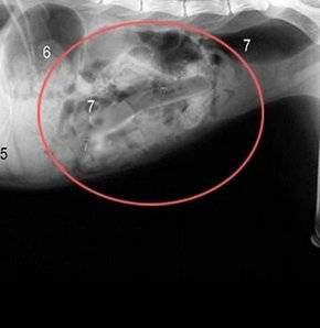 Yok artık diyeceğiniz röntgenler! - Resim: 1