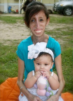 25 kiloluk kız dehşete düşürdü - Resim: 1