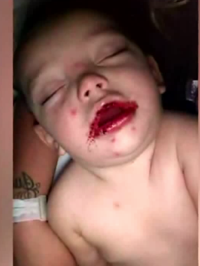 Çocuğunu bir anda bu halde buldu hastaneye koştu gerçekler acı! - Resim: 4