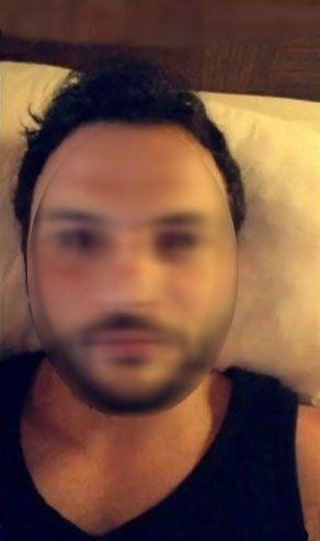 Narkozlu hastanın önce göğsünü sıktı sonra da! Ankara'da hastanede iğrenç olay kameraya yansıdı - Resim: 3