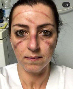 Koronaveirüsle savaşın kahramanları bunlar da kahramanlık izleri - Resim: 4