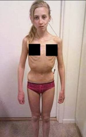 Onu görenler hayrete düşüyordu son hali ise gerçekten inanılmaz - Resim: 1