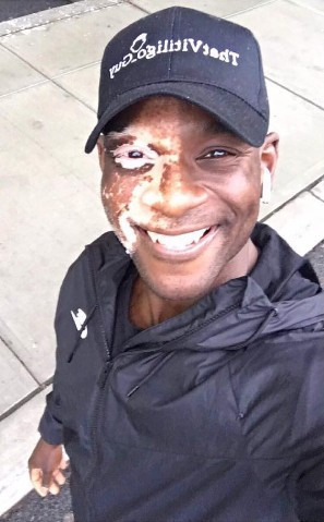 Herkes ona korkarak bakıyordu şimdi peşinden koşuyorlar - Resim: 3