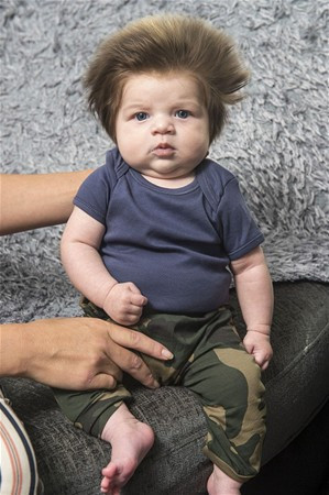 Saçlarıyla fenomen olmuştu bir de son haline bakın saç kalmadı - Resim: 2