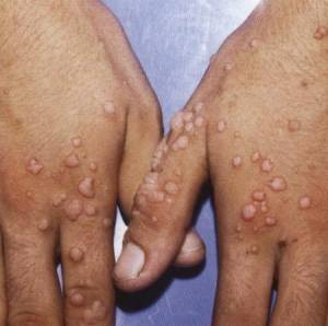 Kocakarı ilaçları - Resim: 2