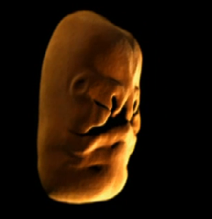 Anne karnında hayat böyle başlıyor - Resim: 3