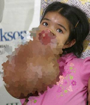 İnanması zor tıbbi vakalar - Resim: 3