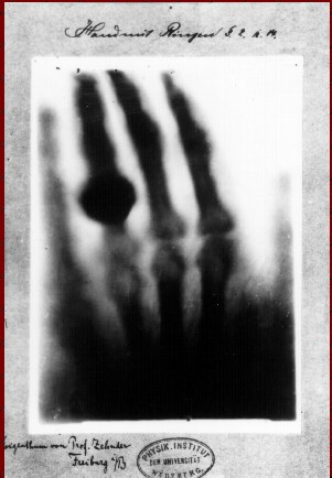 Mucitleri yanlış bilinen 10 icat - Resim: 3