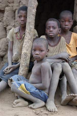 Bu köyde yaşayanlar 'devekuşu' ayaklı - Resim: 3