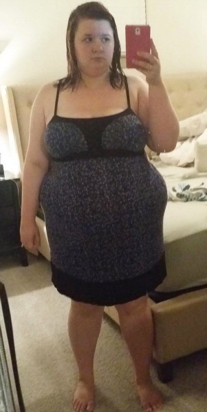 Eski sevgilisinden intikamını acı acı aldı değişimi hayrete düşürdü - Resim: 1