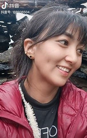 Eski koca TikTok fenomeni kadını canlı yayına hazırlanırken benzin döküp yaktı - Resim: 1