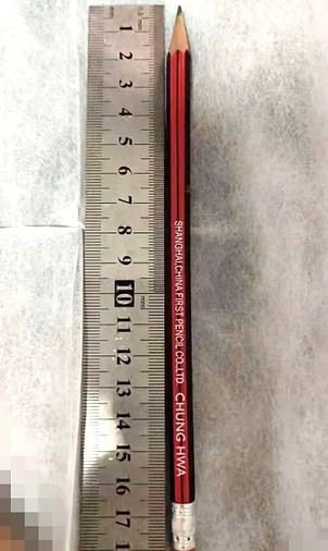 Çin’de 7 yaşındaki çocuk 18 cm'lik kalem yuttu Kung Fu ustalarını taklit ediyormuş - Resim: 0