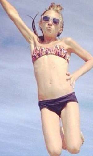 Onu görenler hayrete düşüyordu son hali ise gerçekten inanılmaz - Resim: 4