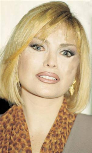 Estetik mucizeleri - Resim: 3