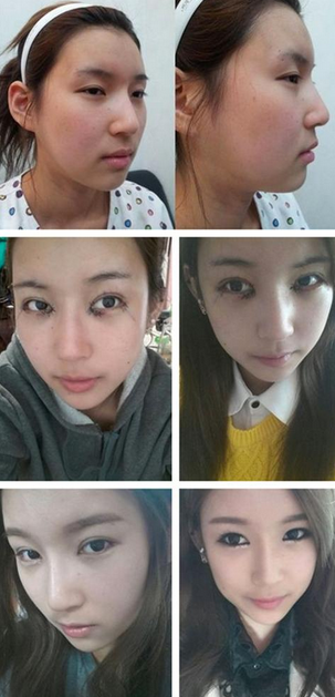 Estetikle öyle değiştiler ki! - Resim: 4