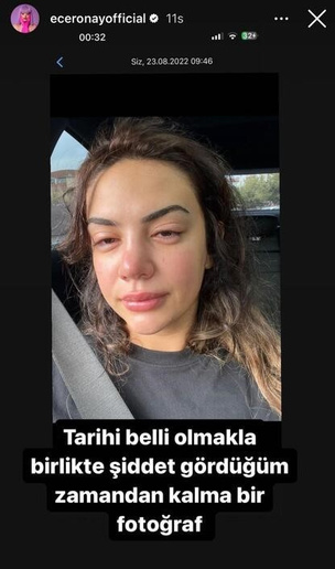 Ece Ronay’ın eski eşine tazyik hapsi verildi - Resim: 0
