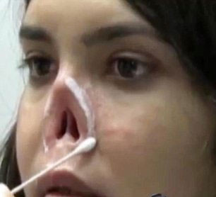 Burnu kesilen Afgan kızı artık gülüyor - Resim: 2