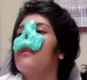 Burnu kesilen Afgan kızı artık gülüyor - Resim: 3