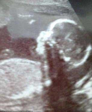 Dünya bu çocuğu konuşuyor! Pinokyo gerçek oldu... - Resim: 4