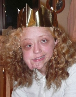 Hayatı boyunca herkes onunla dalga geçti sonrası inanılmaz - Resim: 3