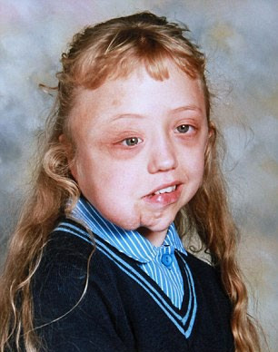 Hayatı boyunca herkes onunla dalga geçti sonrası inanılmaz - Resim: 2