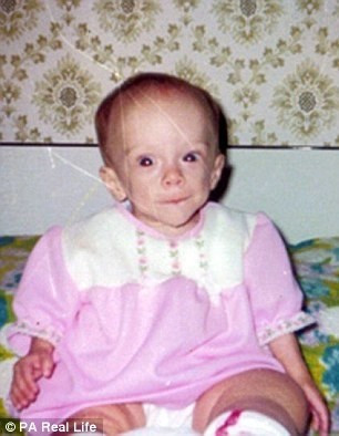 Dünyada bu hastalık sadece onda var - Resim: 1