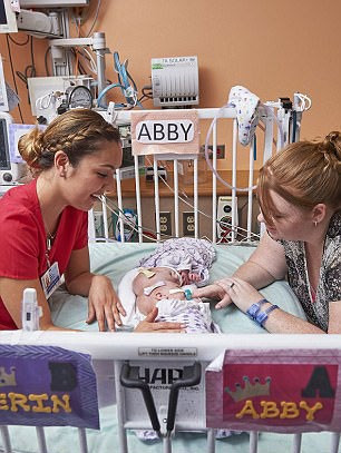 Yapışık ikizlerin ameliyatla ayrıldı  - Resim: 2