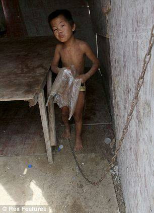 Amcası 12 yaşındaki çocuğu tasmaladı - Resim: 3