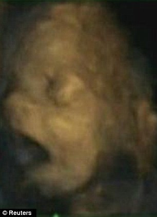 Anne karnındaki bebeğin esneme anları - Resim: 3